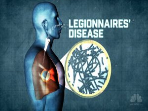 Legionnaires Disease